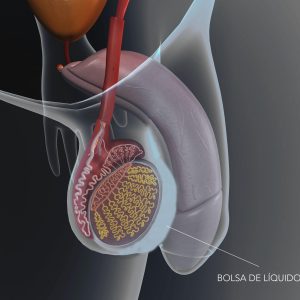 Hidrocele-LOW-scaled