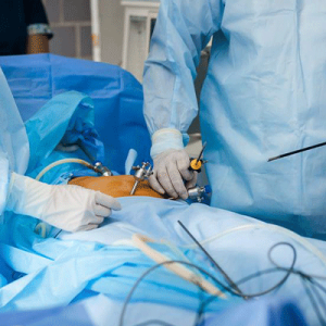 laparoscopy-gi-surgery-img